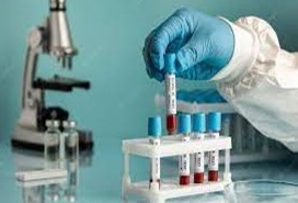 RESEARCH AND DEVELOPMENT